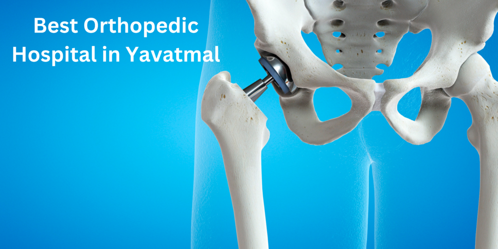 Best Orthopedic Hospital in Yavatmal